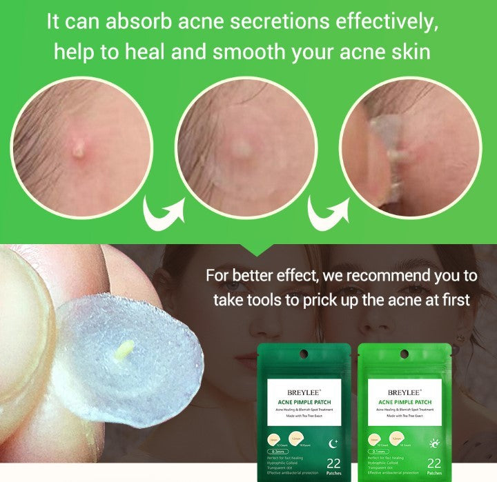 Tea Tree Acne Patches – Ultra-Thin, Scar-Fading & Fast-Healing Spot Treatment