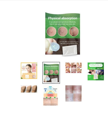 Tea Tree Acne Patches – Ultra-Thin, Scar-Fading & Fast-Healing Spot Treatment