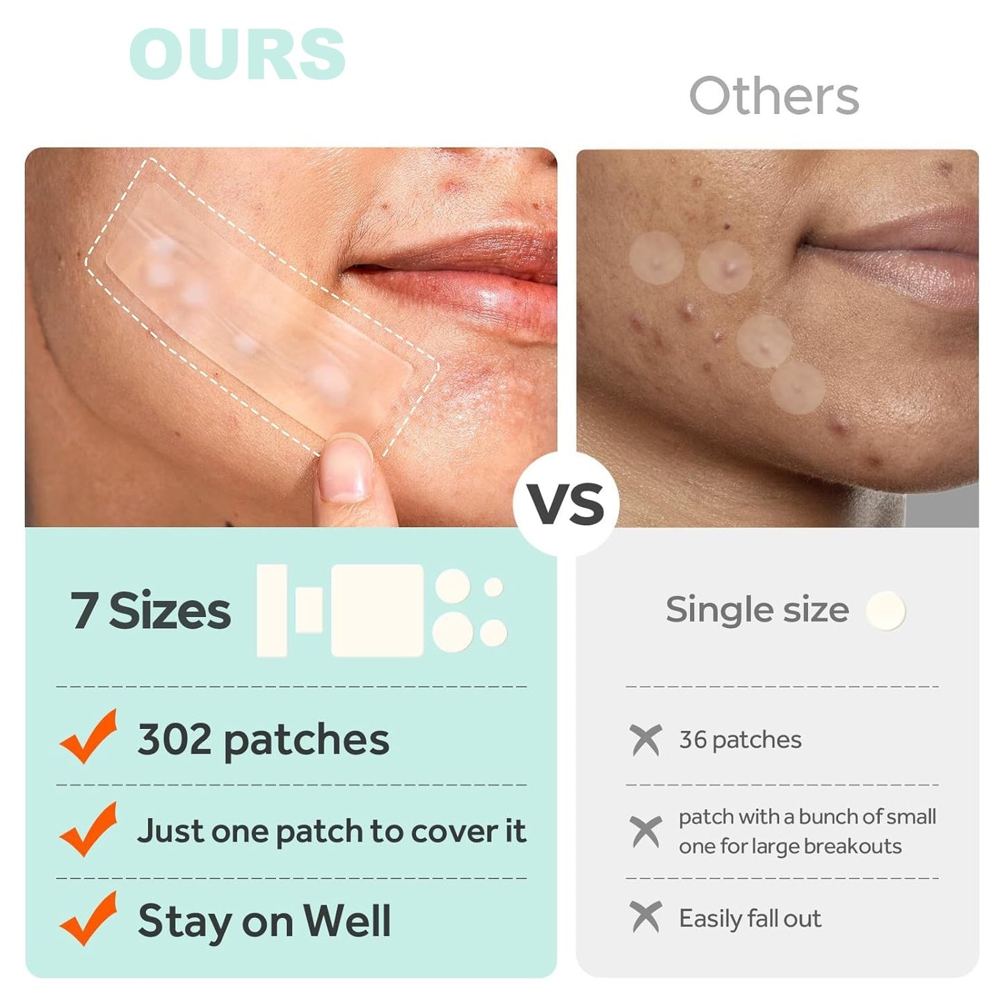 302PCS Invisible Acne Patches – Fast-Healing Spot Treatment for Clearer Skin