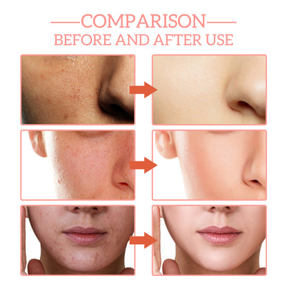 5-in-1 Vitamin C Collagen Facial Serum – Anti-Ageing, Hydrating & Brightening Skincare
